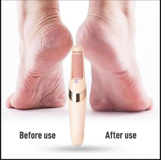 ✨ Rechargeable Electric Pedicure Tool – Smooth & Crack-Free Feet at Home